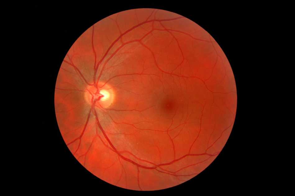 Exploring The Retina: The Gateway To Clear Vision