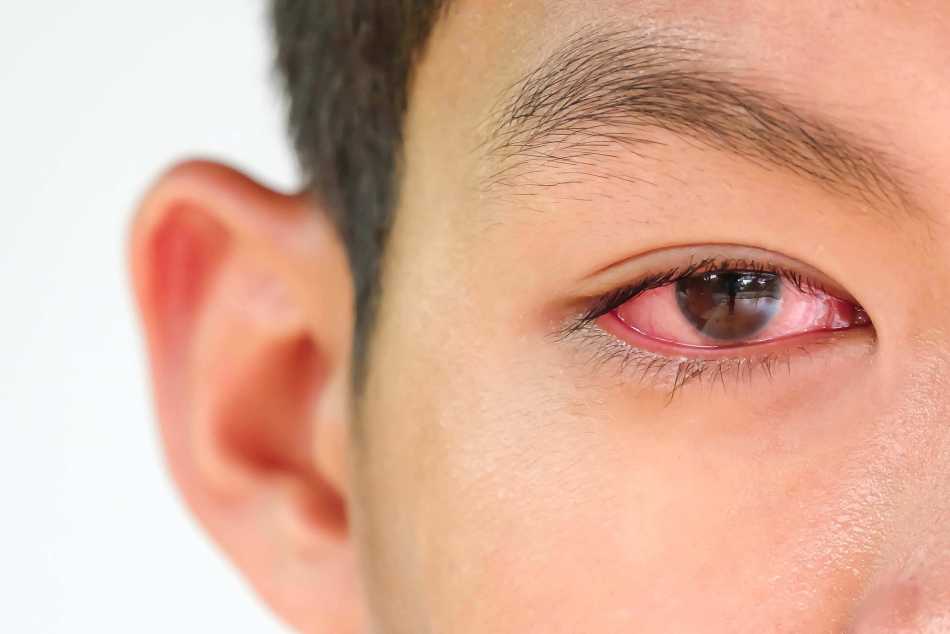 What Are The Causes Of Eye Pain